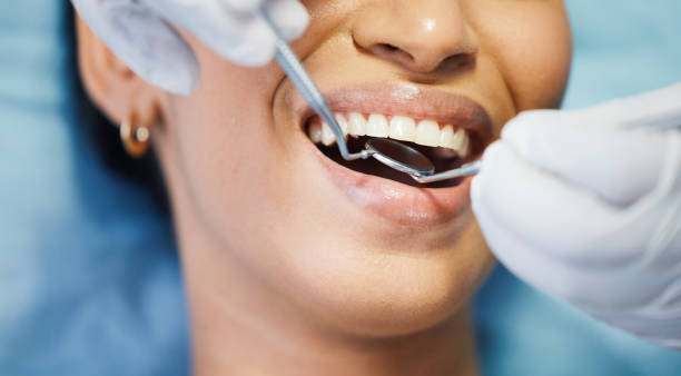 Best Broken or Chipped Tooth Repair in Taylorvle, IL